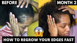 How to Grow Your Edge Back FAST | Regrowz 2 Month Update