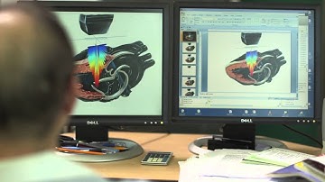 XDI Imaging Technology on the All New X-Porte Ultrasound Kiosk From Sonosite