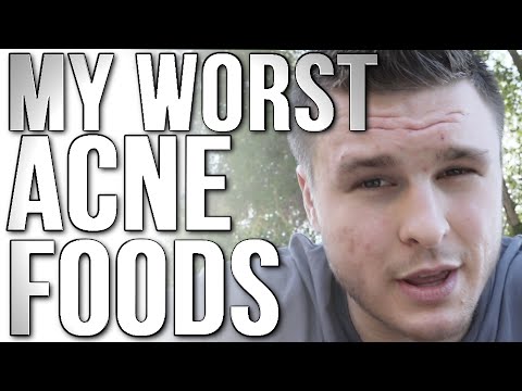 The Two Worst Acne Foods & the Best Food for Acne