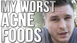 The Two Worst Acne Foods & the Best Food for Acne