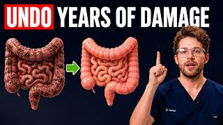 Gut Detox: The Fastest Way To Repair Your Gut Naturally (Backed by Science)