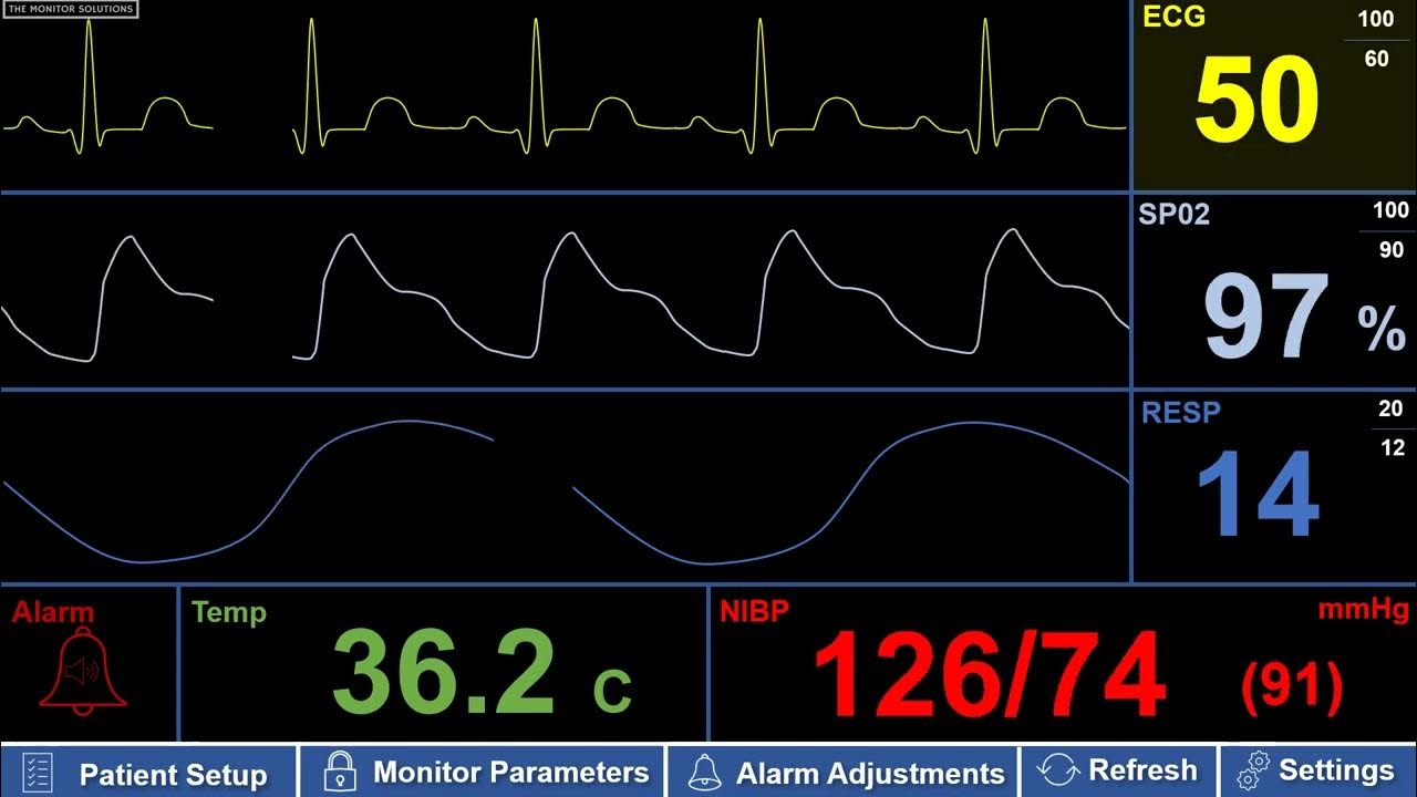 simulated-adult-patient-monitor-with-bradycardia-low-heart-rate-youtube