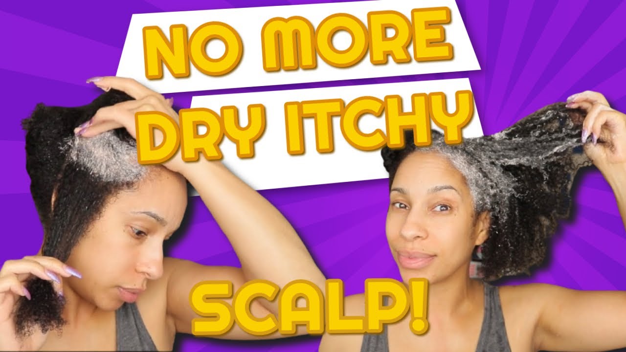 DRY ITCHY SCALP TREATMENT FOR BLACK HAIR - HAIR SCRUB - ZIONHEALTH - YouTube