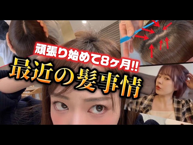 頑張り始めて8ヶ月!!最近の髪事情🔥🔥🔥