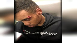 Parents demand justice for teen they said was assaulted by deputy at school