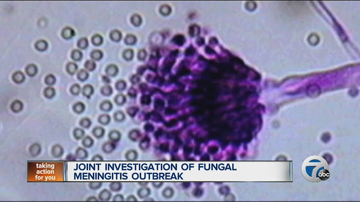 A report was created that outlined the outbreak of a disease called fungal meningitis