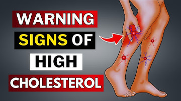 Silent Signs of Artery Blockages You Can’t Ignore