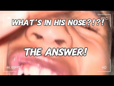 YOU CANT MAKE THIS STUFF UP PART 2- WHAT IS IN HIS NOSE?! THE REVEAL! PARENTS CHECK YOUR KID'S NOSE!