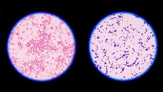 Staining technique in microbiology: Gram staining