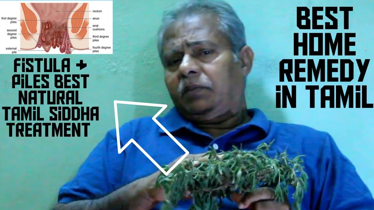 Fistula and Piles Best Natural Tamil Siddha Treatment In Tamil