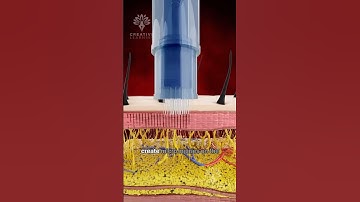 How Can the Derma Pen Transform Your Skin😲 #shorts #microneedling #viralvideo - creativelearning3d