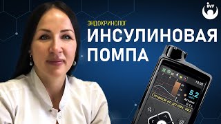 Инсулиновая помпа и  лечение сахарного диабета. Эндокринолог Екатерина Маляр