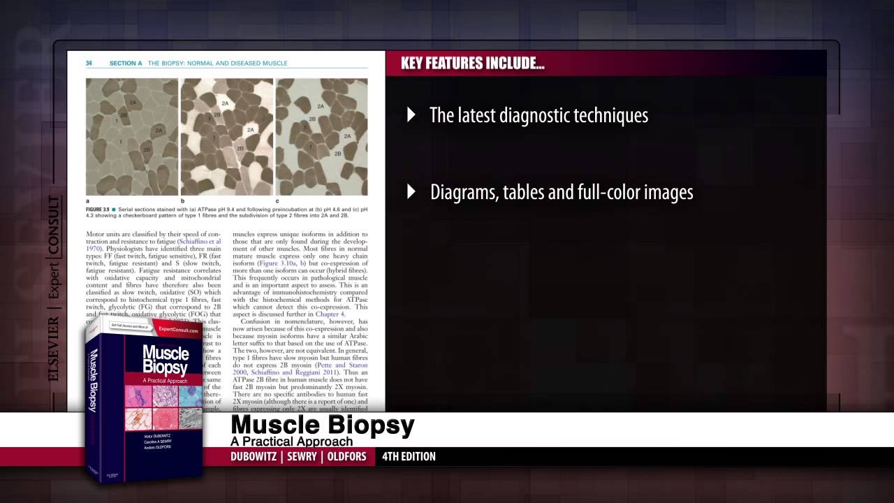 Muscle Biopsy: A Practical Approach, 4th Edition - YouTube
