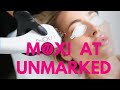 Top Arizona Med Spa Talks About Moxi by Sciton! ￼