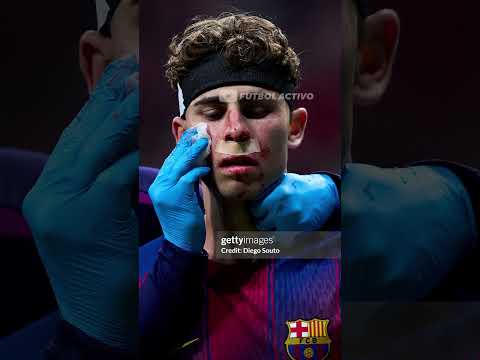 el mejor torneo de la historia thumbnail