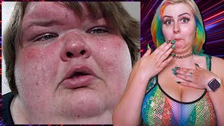 Do We See GROWTH Emotionally From Tammy? | 1000lb Sisters Reaction S1E4