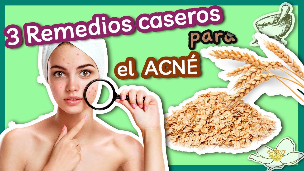 3 Remedios Caseros Para El Acné Youtube