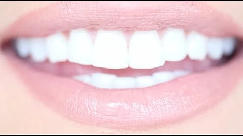 How to Get Really White Teeth For Cheap | Kandee J...