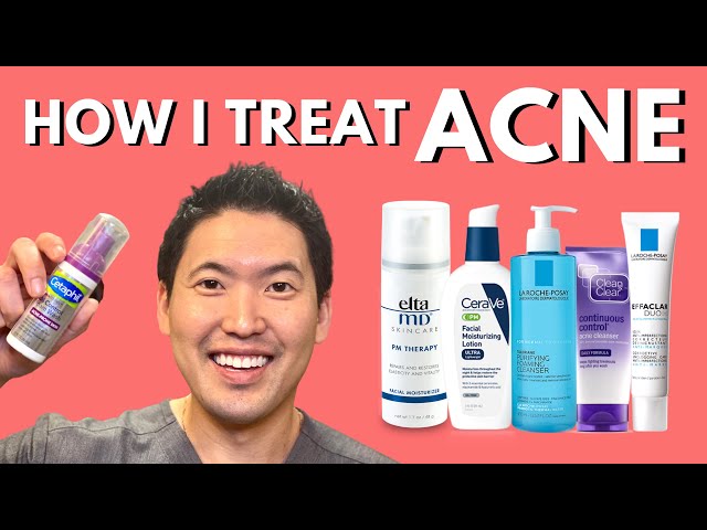 How I Treat Acne: An Overview of Treatment Options class=