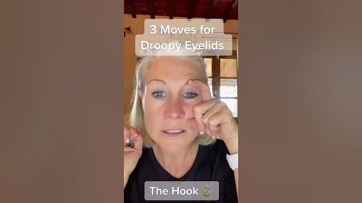 3 Exercises for droopy eyelids These 3 moves will strengthen your eye muscle. Due to excessive scre