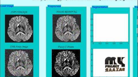 Final Year Projects | Spatially Coherent Fuzzy Clustering for Accurate and Noise-Robust