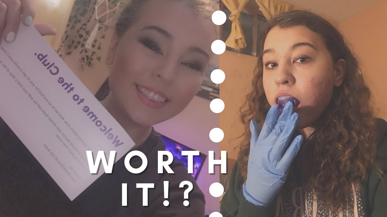 BRACES AND TIK TOK LEGGINGS! Are they worth buying?? YouTube