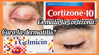 Puedo usar cortizona? es dañina? tengo dermatitis / ezcema / alergias en la piel
