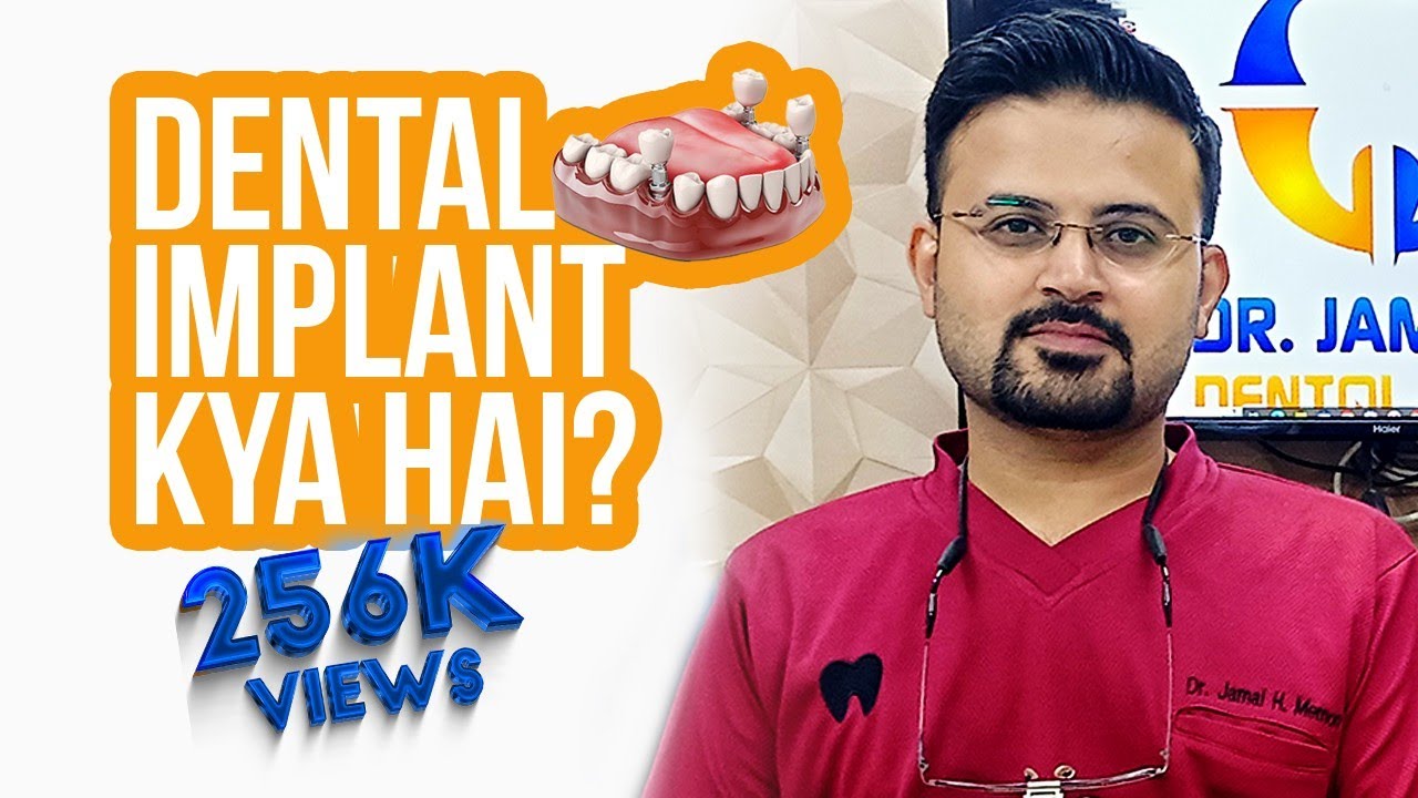 Dental Implant kya he? Best option for replacing missing teeth