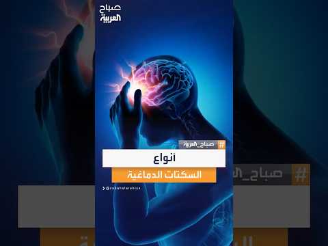 اختصاصي المخ والأعصاب عبد الرحمن الشمري من مستشفى الموسى التخصصي يشرح أنواع السكتات الدماغية