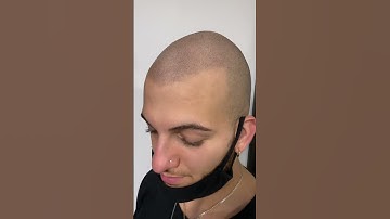 Scalp micropigmentation in HD (up close) Part #1