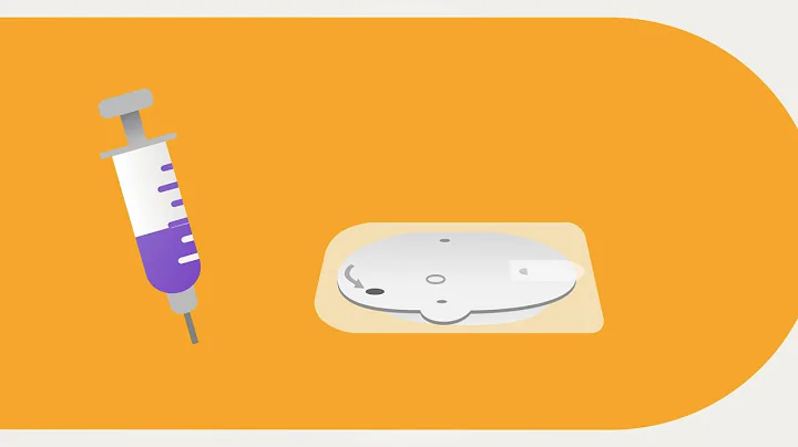 Omnipod® 5 Automated Insulin Delivery System Product Training - Pod Activation