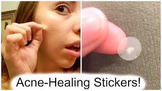 I Tried Acne-Healing Stickers...Does It Work?