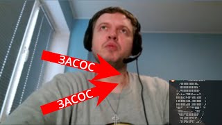 Папич про "засосы" на шее