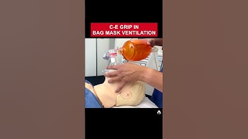 C-E Grip in Bag Mask Ventilation | #anesthesia #bagmaskventilation #airway