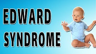 Edward Syndrome