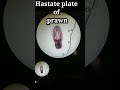 🔬 Microscope ke neeche Prawn ka Hastate Plate #prawn #microscope #biologyshorts #practical #ranjan
