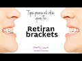 Tips para el día que te retiran BRACKETS