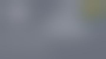 Right Liver Mobilization