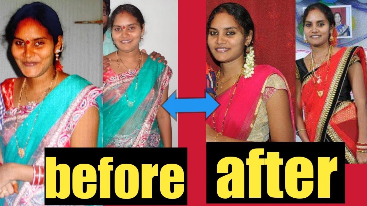 Healthy fast weight loss with no dieting...loss 5 to 6kg per month