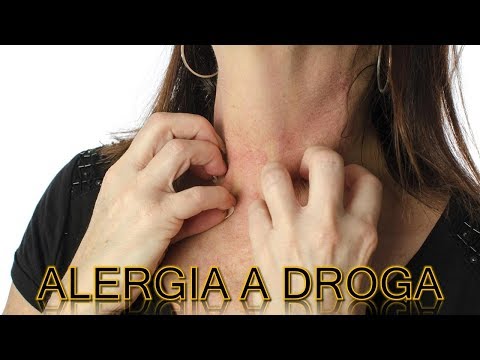 Vídeo: Alergia A Las Drogas