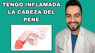 TENGO INFLAMADA LA CABEZA DEL P3N3 / B4L4NITIS | DR. DAVID CAMPOS