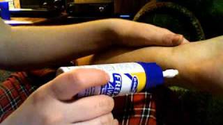 Dr. Scholl's Freeze Away Warts Common And Planters Test! How To Dr Scholls