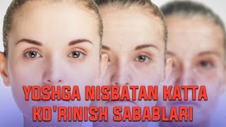 YOSHGA NISBATAN KATTA KO'RINISH SABABLARI