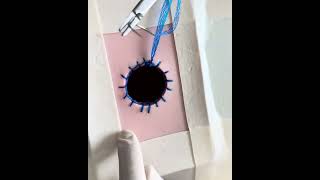 Duramesh™ technique for Parastomal Hernia Repair (Artificial Simulation)