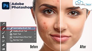 Learn How to Quickly Smooth Skin, Remove Scars and Blemishes in Photoshop | Photoshop Tutorial