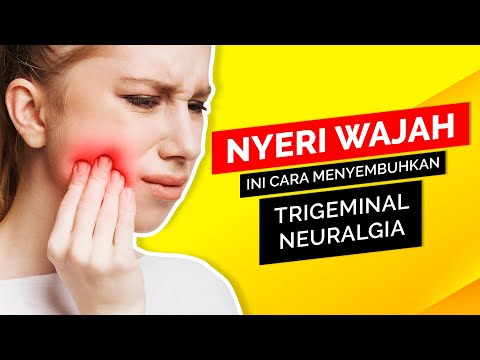 Nyeri Wajah Parah Ini Cara Menyembuhkan Trigeminal Neuralgia. 