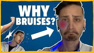 Why Do We Get Colourful Bruises? - QUACK #7