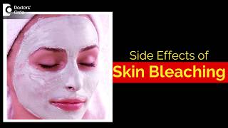 What are the side effects of bleaching your skin? - Dr. Aruna Prasad