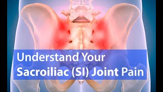 Sacroiliac (SI) Joint Pain: EVERYTHING YOU SHOULD KNOW