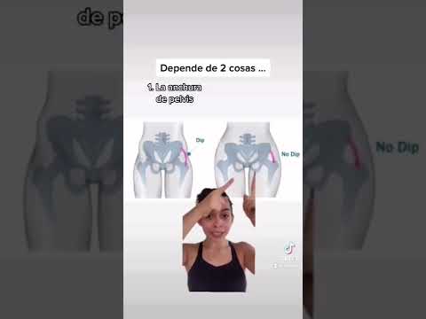Quieres quitar HIP